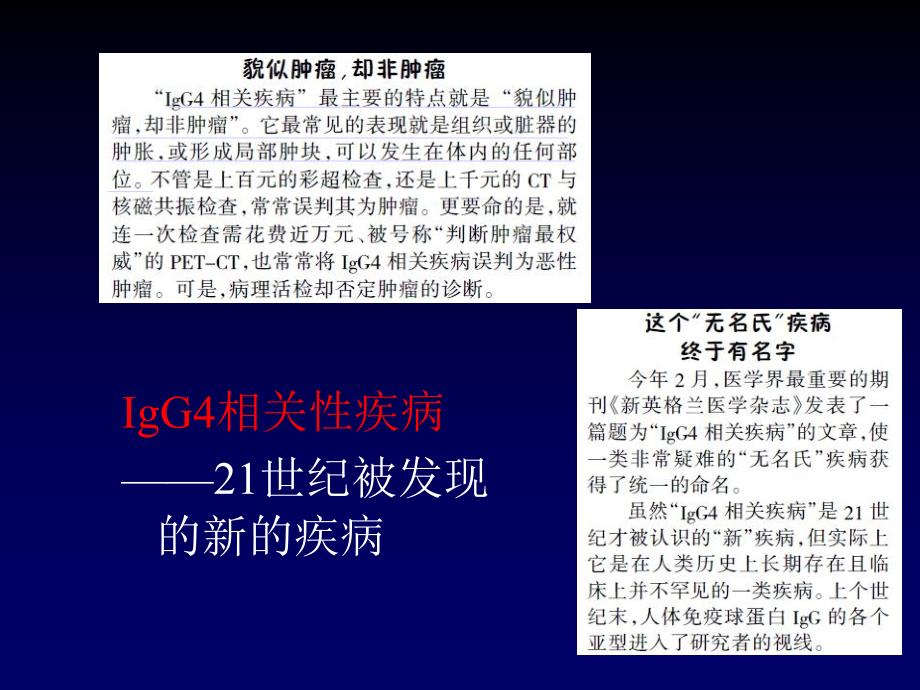 IgG4相关性疾病的诊治ppt课件_第2页