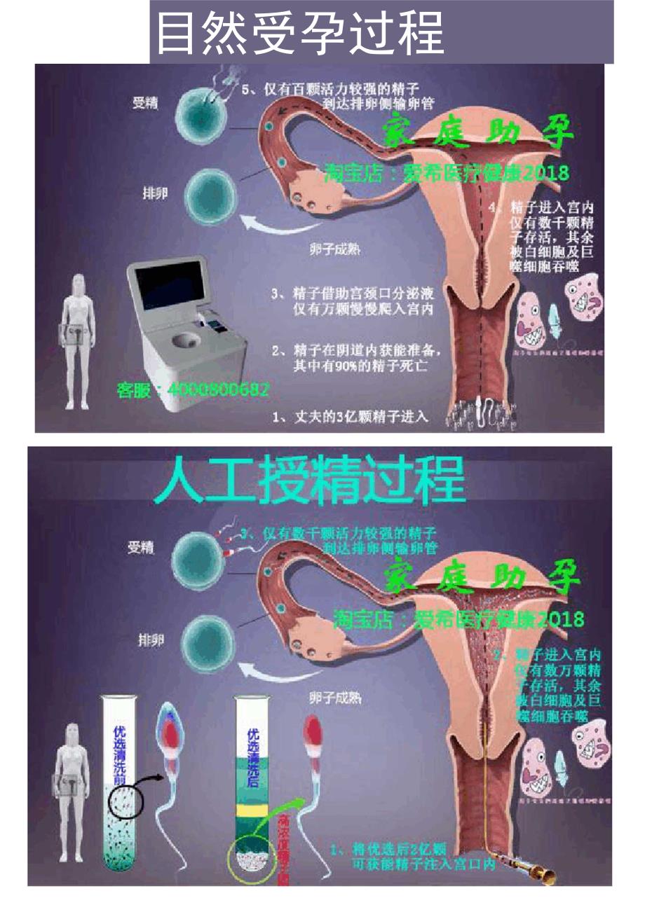 家庭人工授精过程_第3页