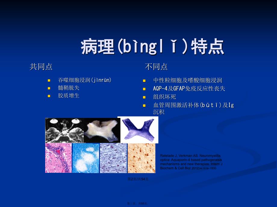 NMO的免疫治疗进展学习教案_第3页