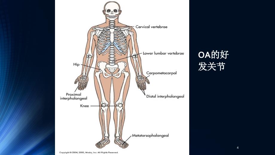 关节炎的物理及常规实验室检查ppt课件_第4页