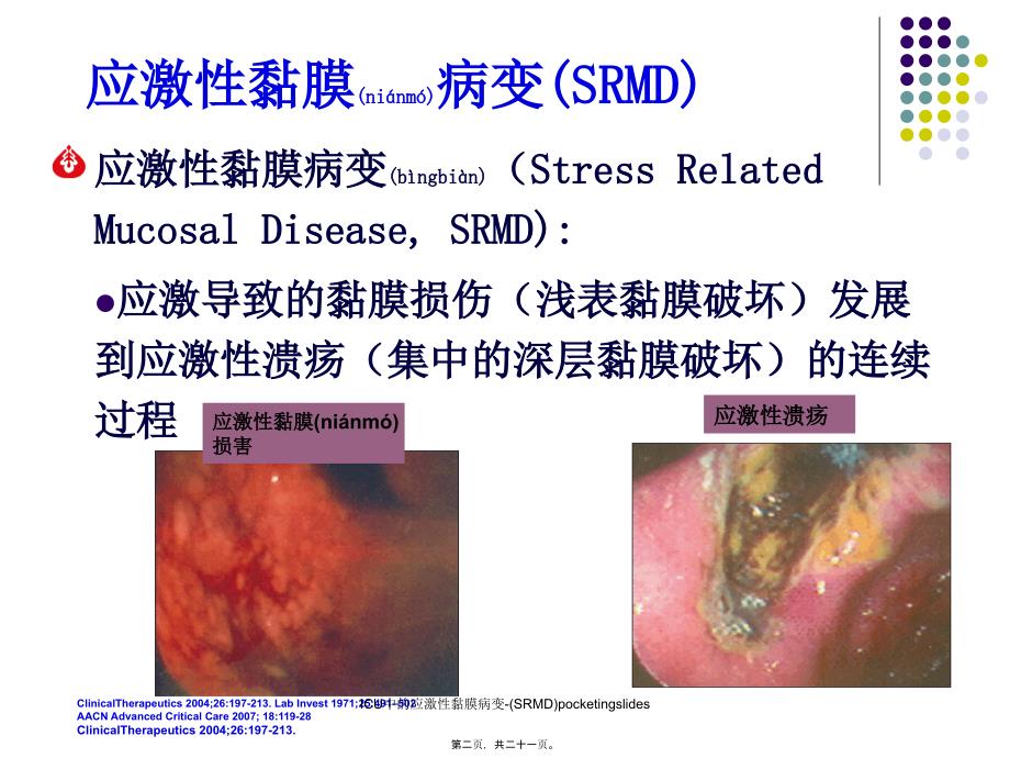 ICU中的应激性黏膜病变-(SRMD)pocketingslides课件_第2页