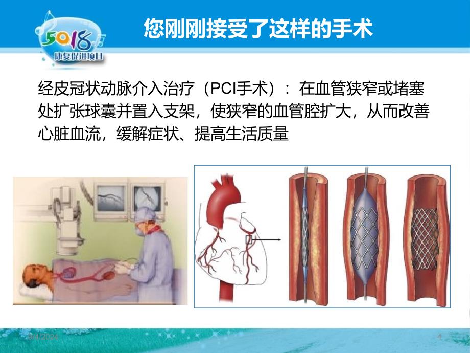 PCI术后的自我健康管理课件_第4页