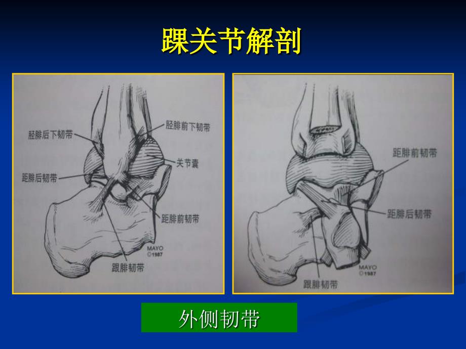 踝关节影像诊断_第3页