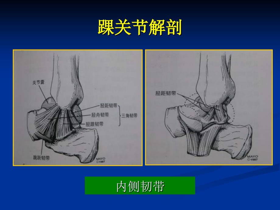 踝关节影像诊断_第4页