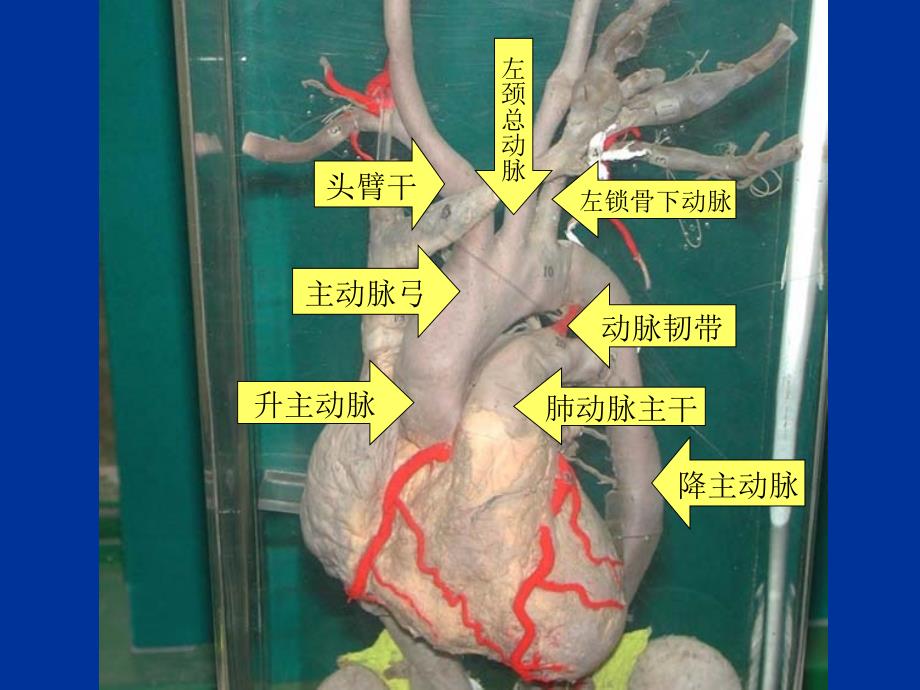 动脉循环播放PPT课件_第1页