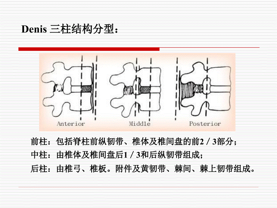 胸腰椎骨折治疗进展_第4页