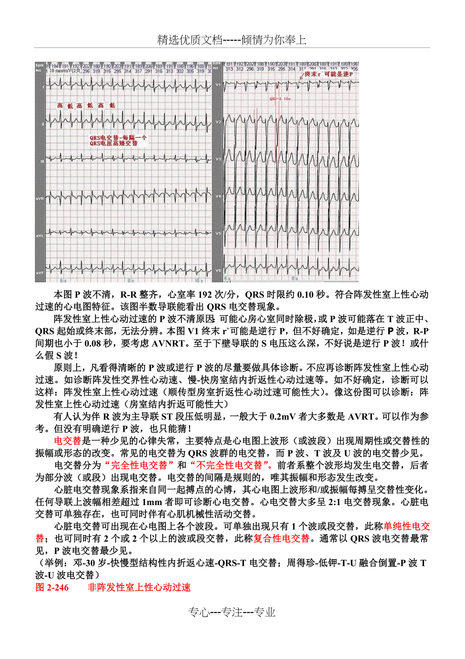 另类心电图讲义-7---室上速、折返性心律失常发生机理(共7页)_第2页