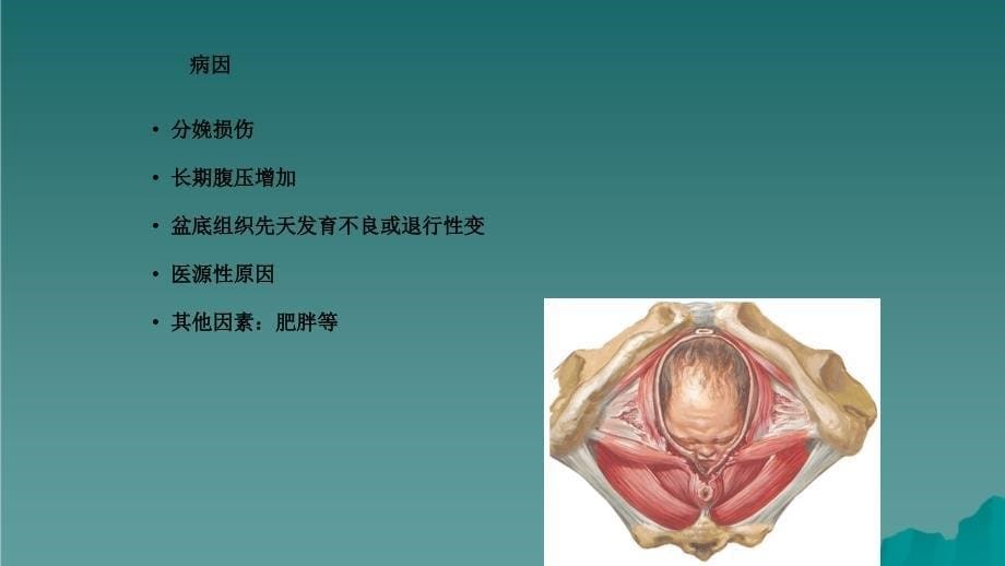 盆腔器官脱垂干货分享_第5页