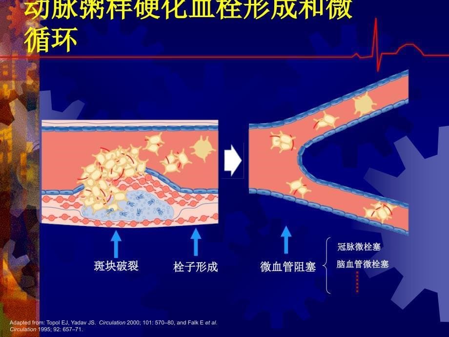 抗血小板药和抗凝药的临床合理应用文档资料_第5页