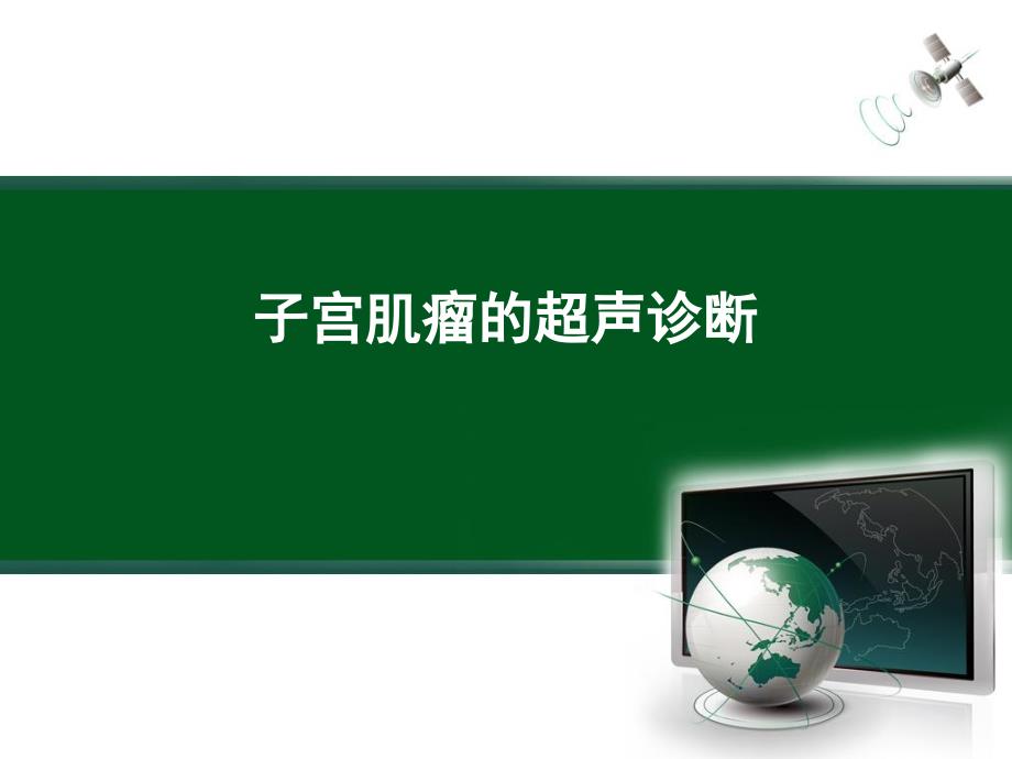 子宫肌瘤的超声诊断_第1页