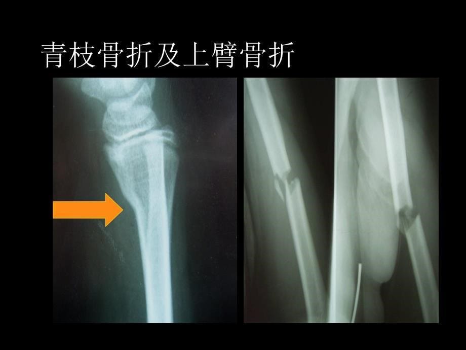 骨与关节系统医学PPT课件_第5页