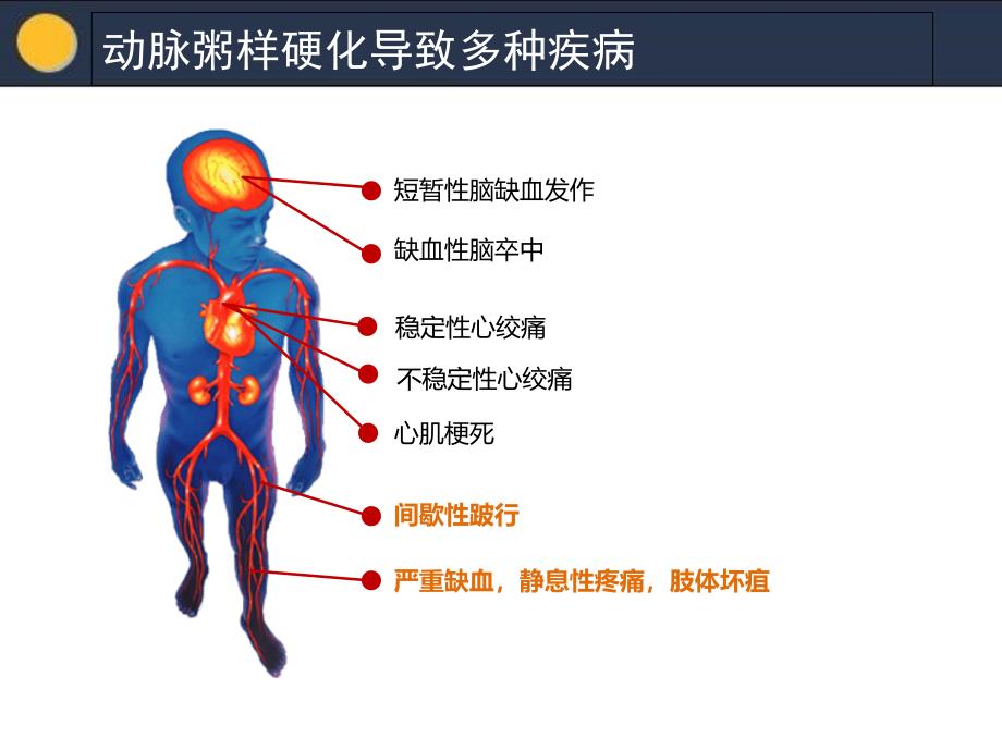 下肢动脉硬化闭塞症共31页复习课程课件_第3页