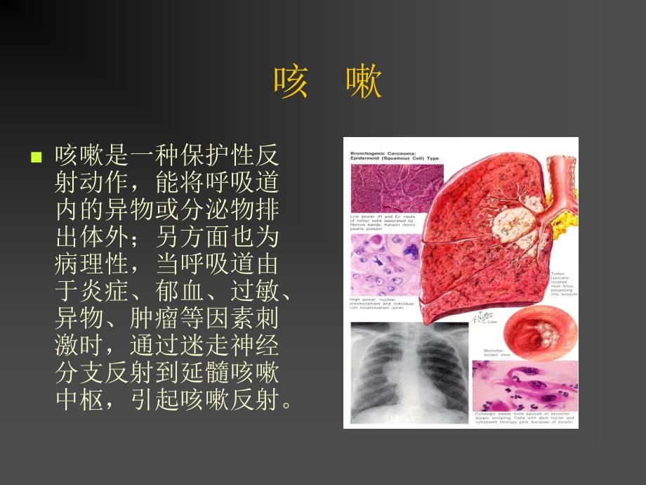 心胸外科常见病征的诊断思路_第2页