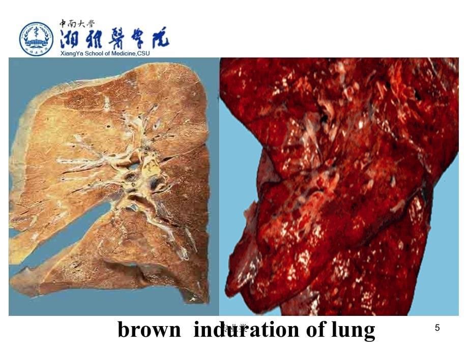 血液循环障碍专业相关_第5页