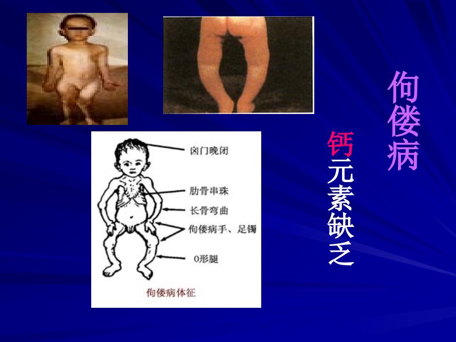 课题2化学元素与人体健康课件_第4页