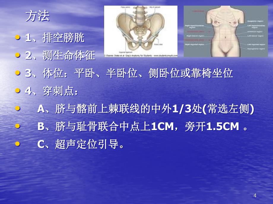 优质课件内科四大穿刺术_第4页