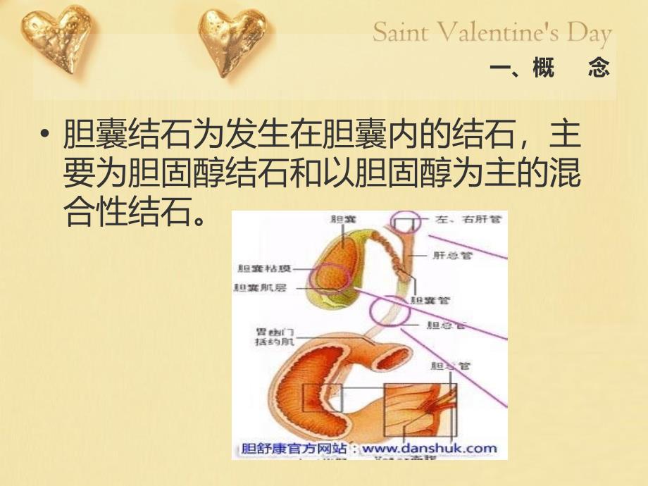 胆囊结石患者的护理.ppt_第2页