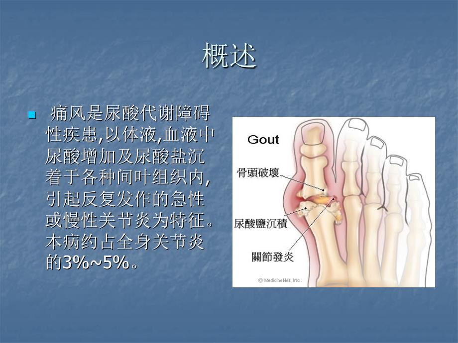 痛风性关节炎_第2页