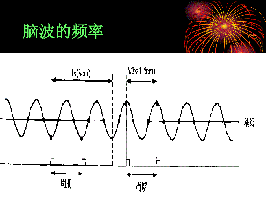 脑电图判读.ppt_第3页