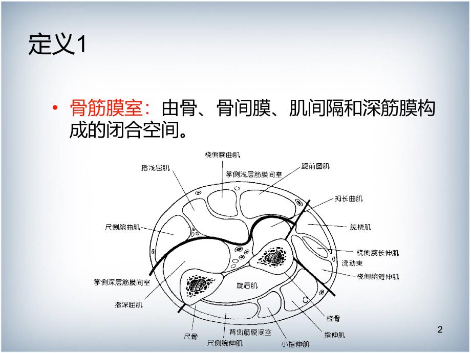 骨筋膜室综合征ppt课件_第2页