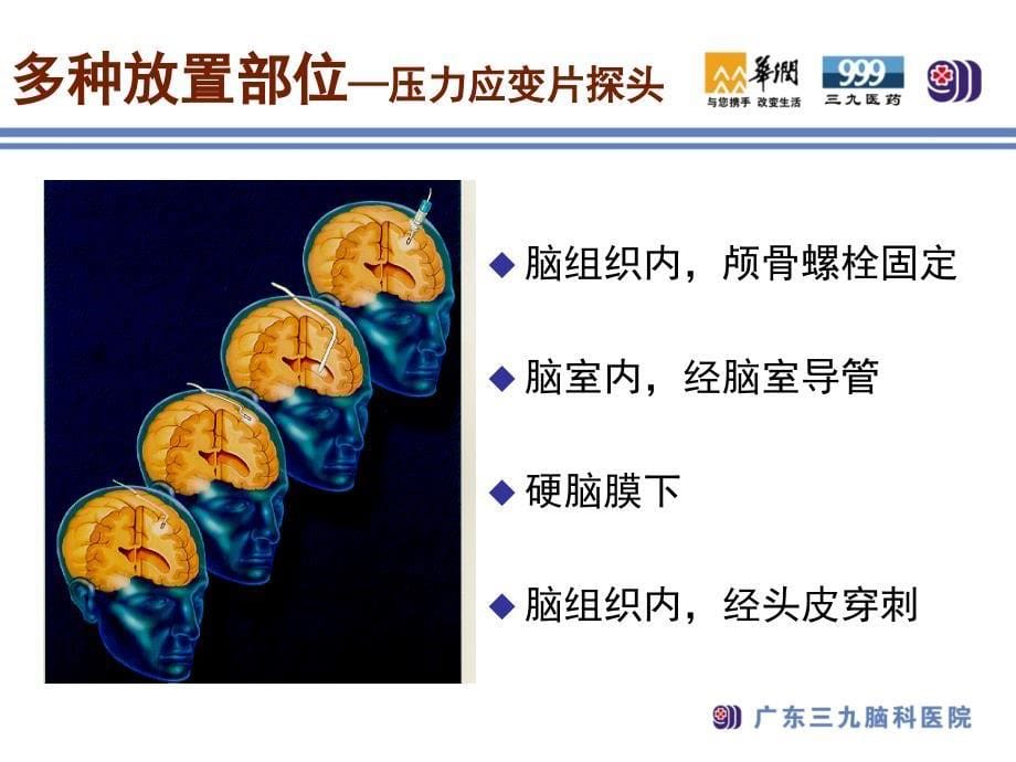 持续有创颅内压监测及护理-共29页PPT课件_第5页