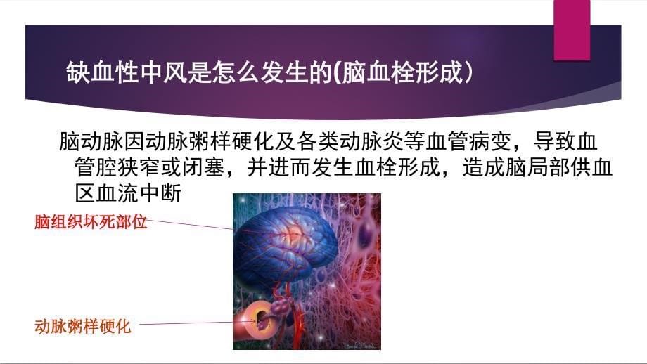 老年人脑血管病的预防_第5页