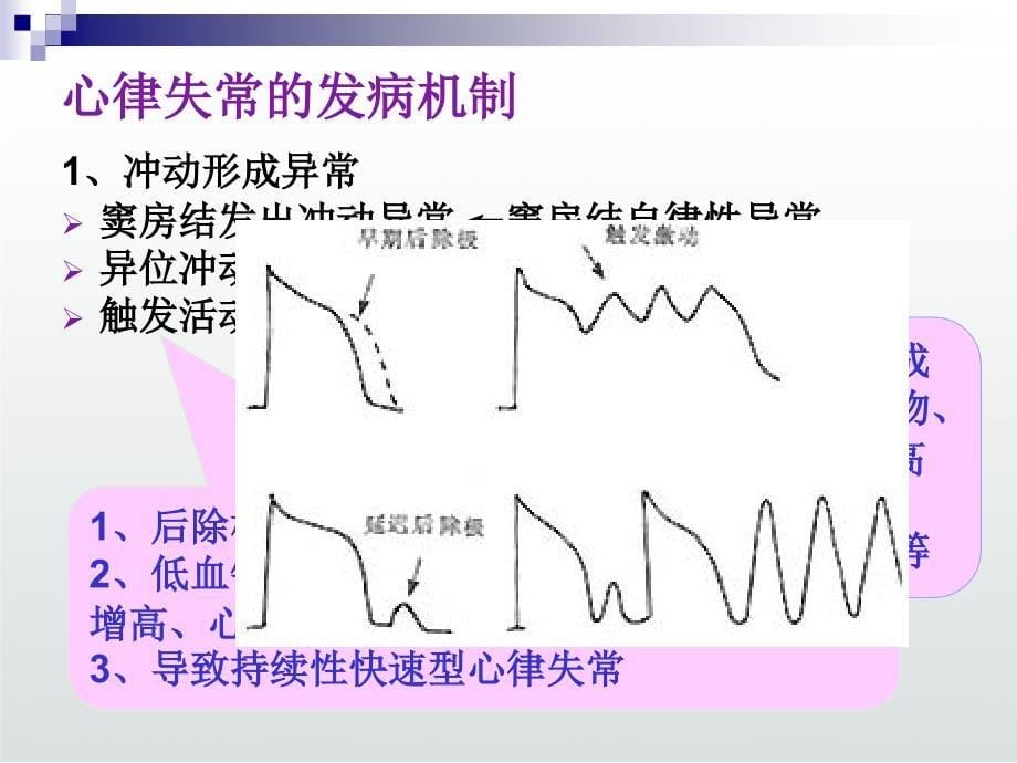 心律失常病人的护理课件_第5页