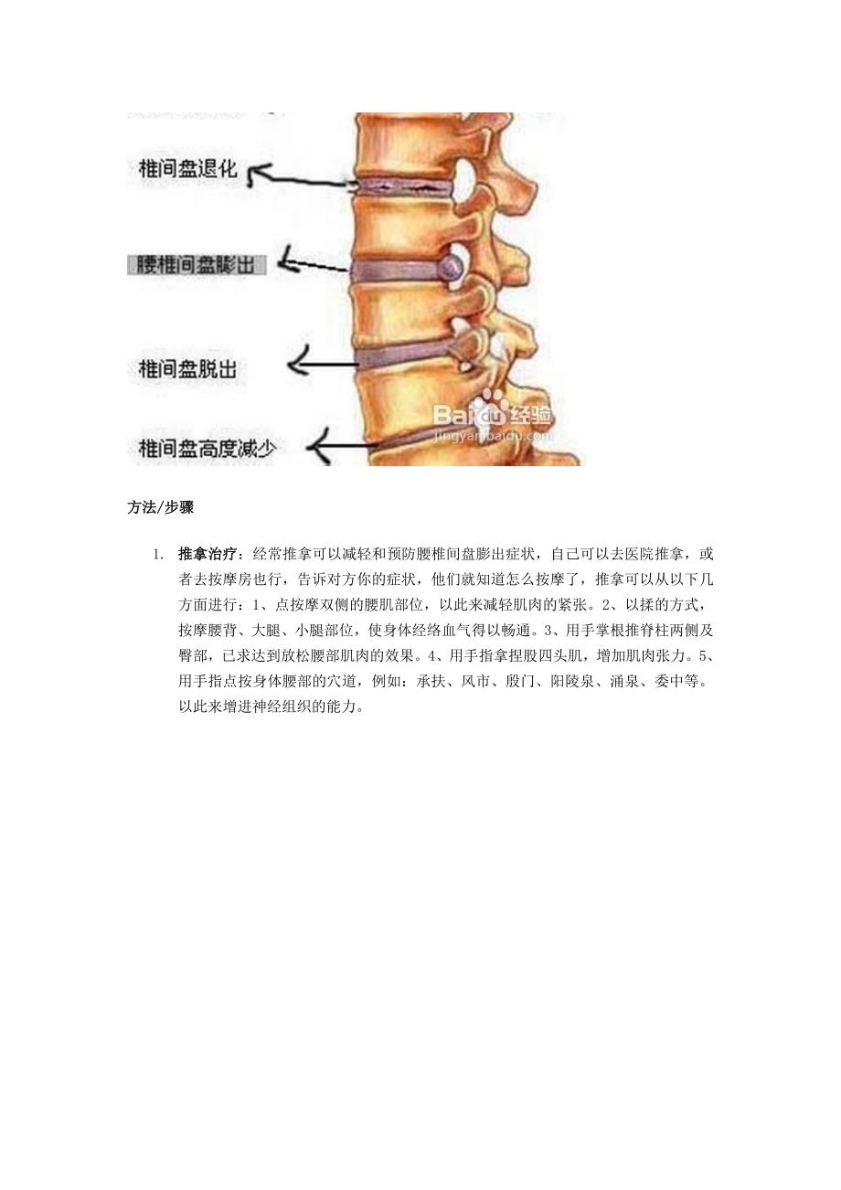 腰病的防治方法_第2页