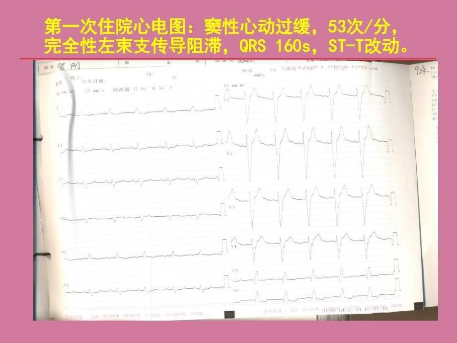 心力衰竭病例分析精品ppt课件_第5页