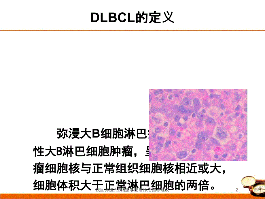 我国弥漫大B细胞淋巴瘤诊治指导建议培训课件_第2页