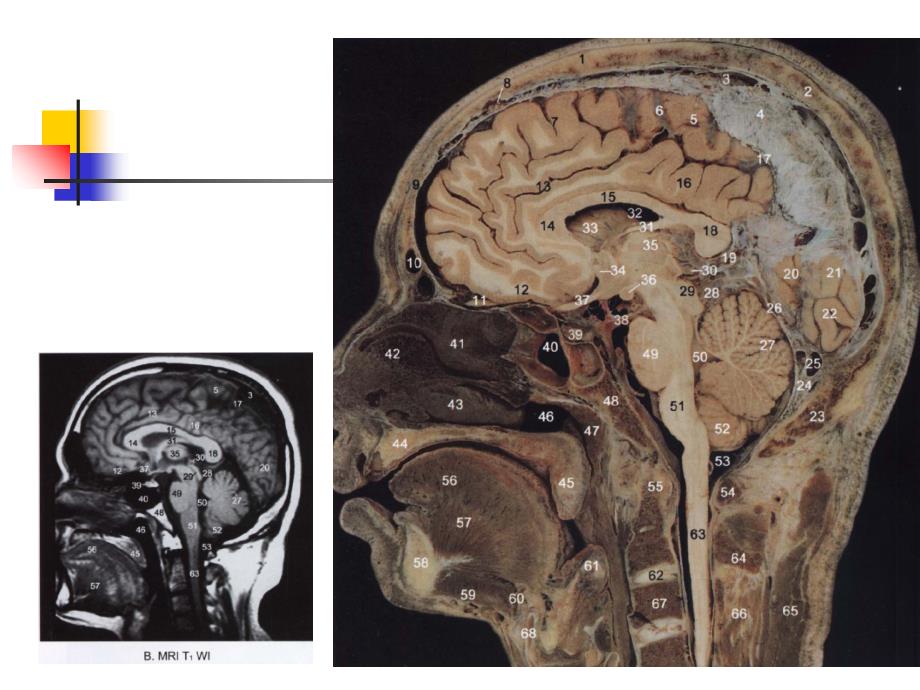 头部的矢状断层解剖_第3页