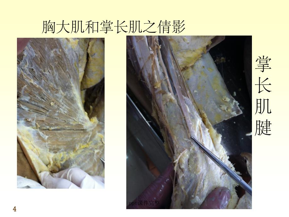 上肢局部解剖课件_第4页