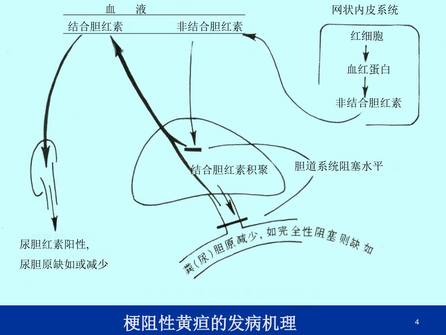 胆汁淤积性疾病ppt课件_第4页