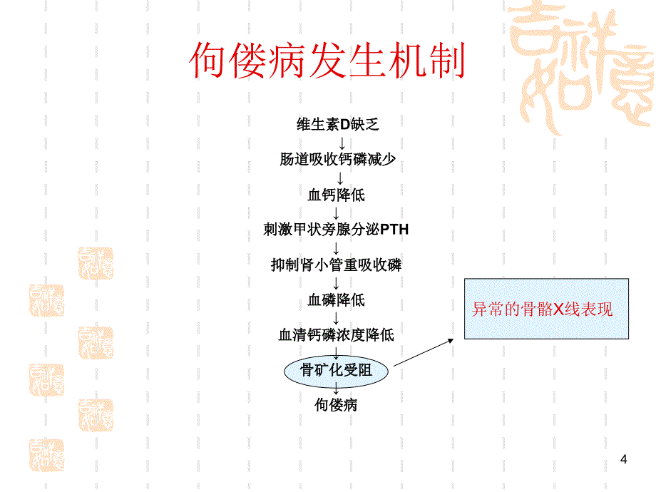 佝偻病的影像学特点_第4页