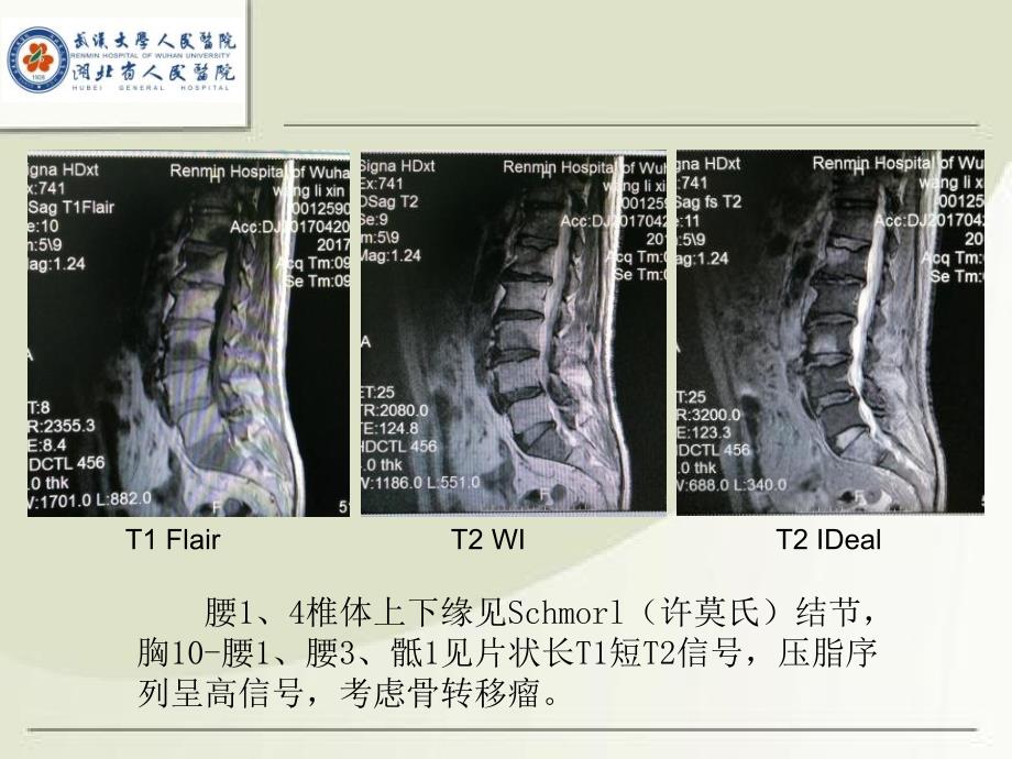 mri诊断入门病例PPT课件_第2页