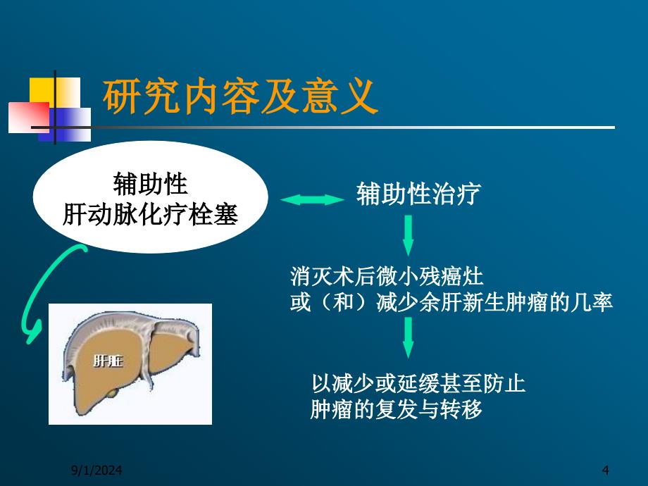 肝癌术后辅助性肝动脉化疗栓塞_第4页