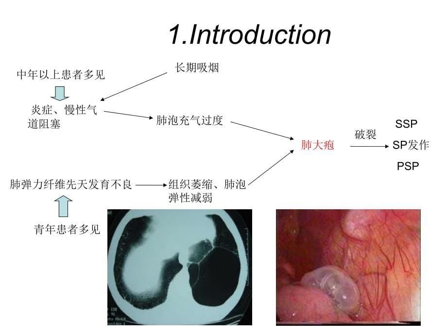 自发性气胸的临床治疗指南2010版解读_第5页