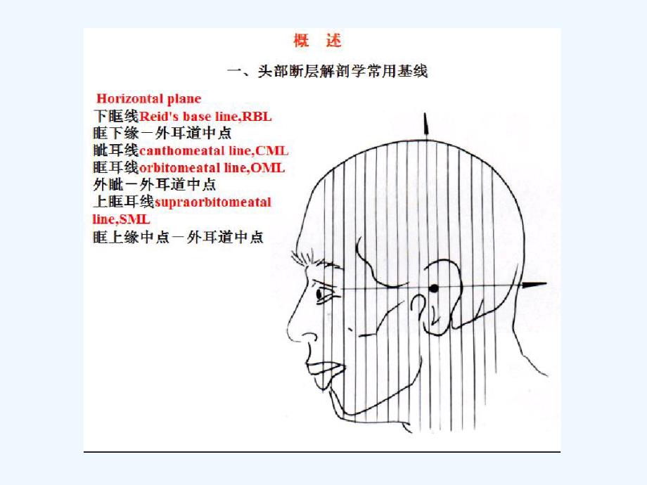 头颅MRI断层解剖课件_第2页