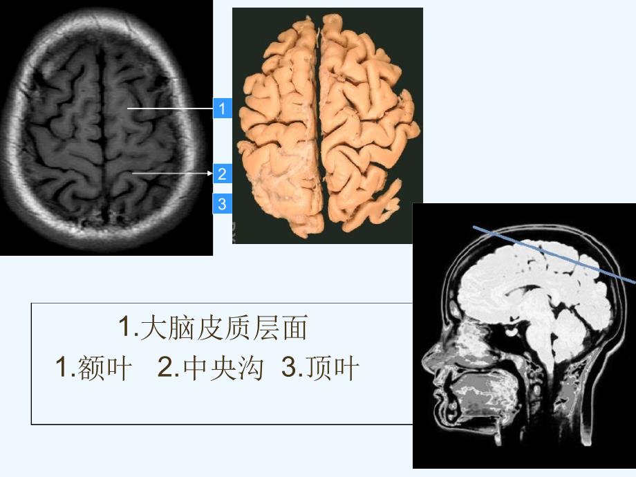 头颅MRI断层解剖课件_第4页