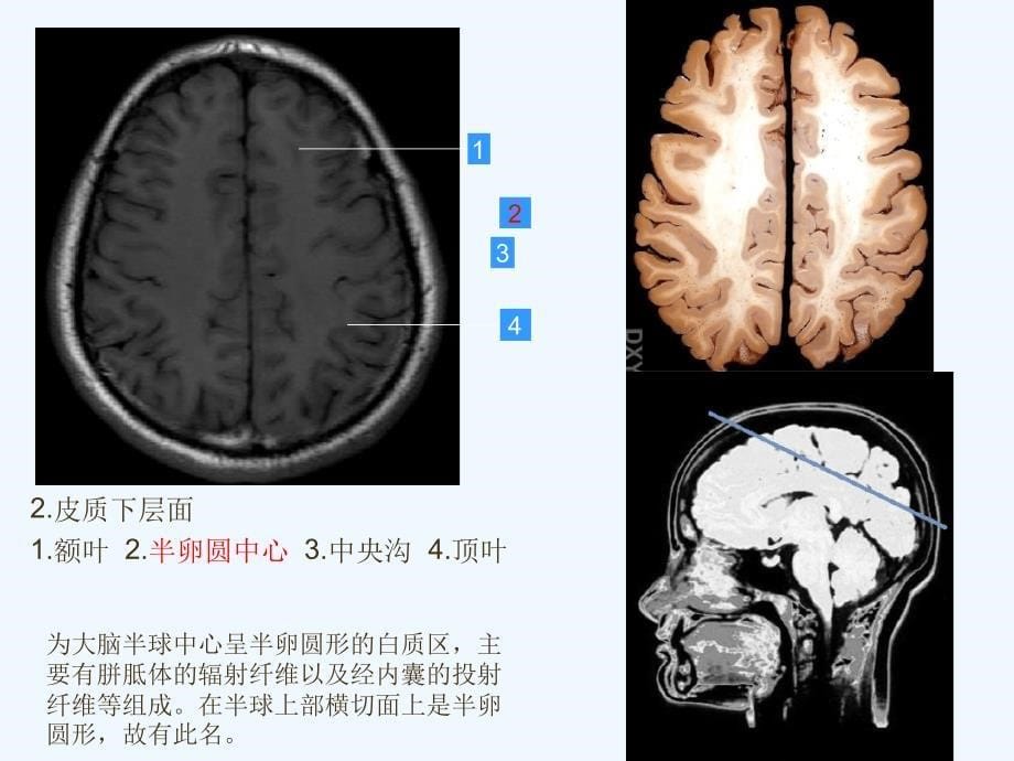 头颅MRI断层解剖课件_第5页