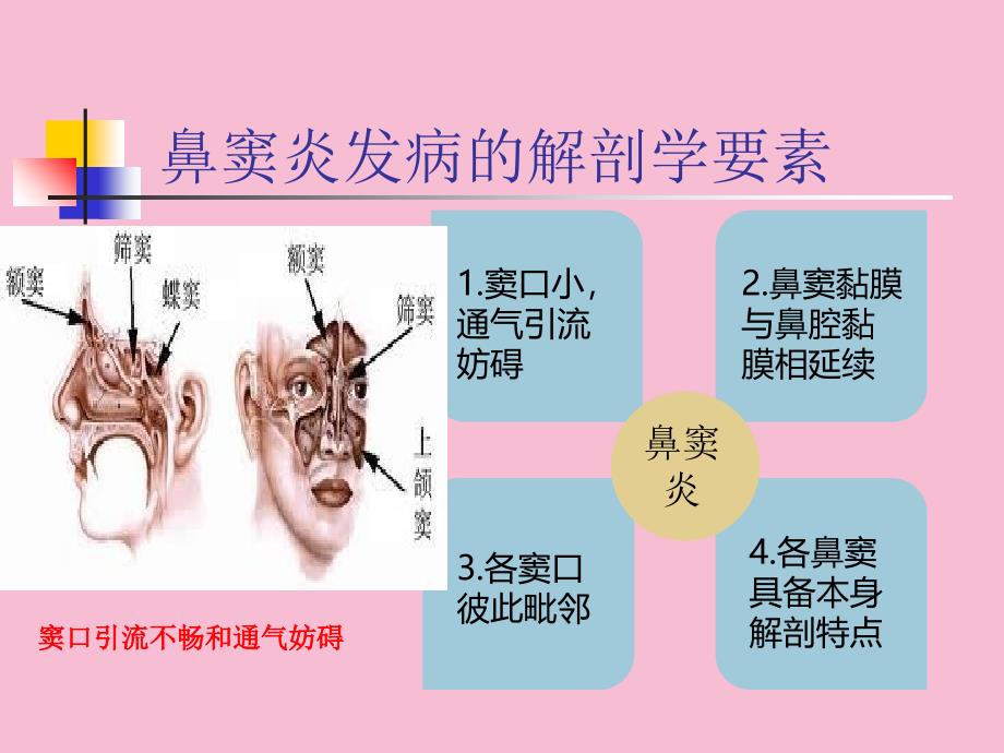 耳鼻咽喉头颈外科学二13急慢性鼻窦炎ppt课件_第3页