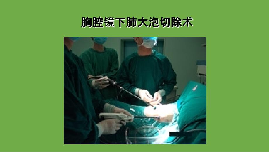 胸腔镜下肺大泡切除_第1页