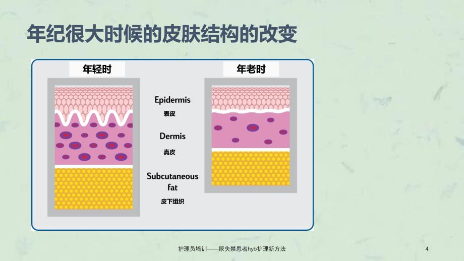 护理员培训尿失禁患者hyb护理新方法课件_第4页