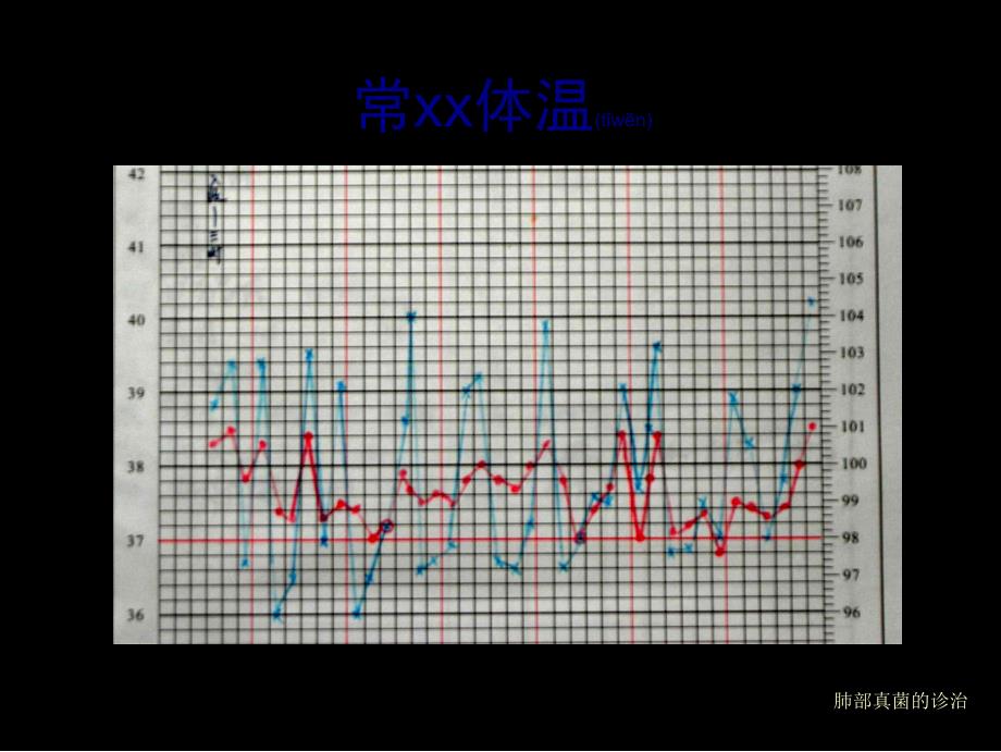 肺部真菌的诊治课件_第3页