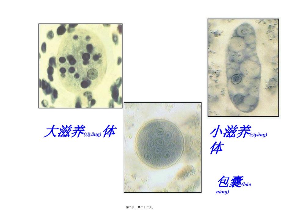 医学专题—抗阿米巴虫驱肠虫药16286_第2页