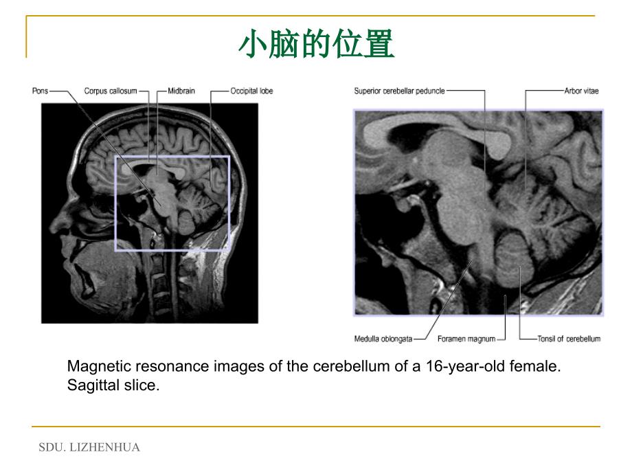 小脑-cerebellum汇总_第5页