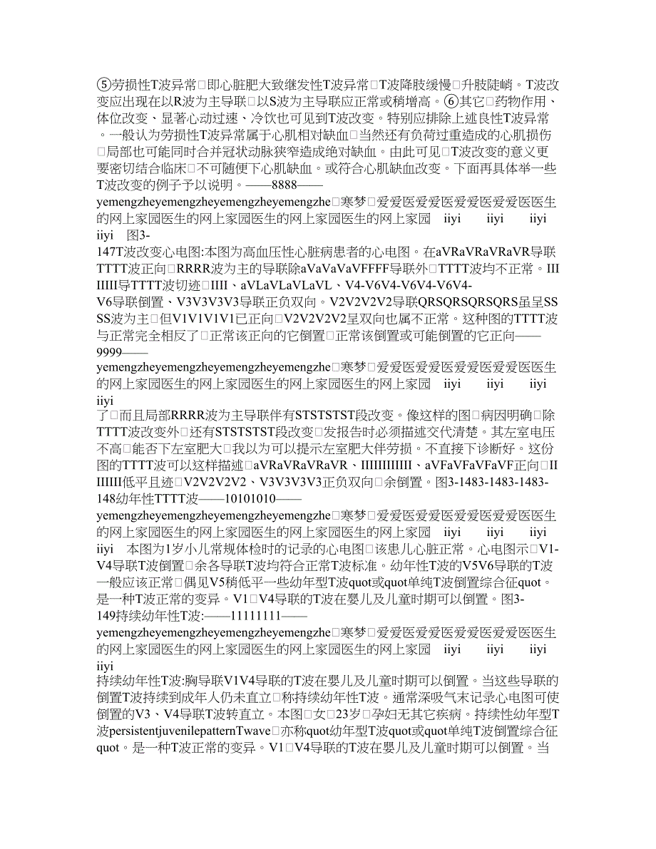 常见心电图 基础知识讲座 T波分析_第4页