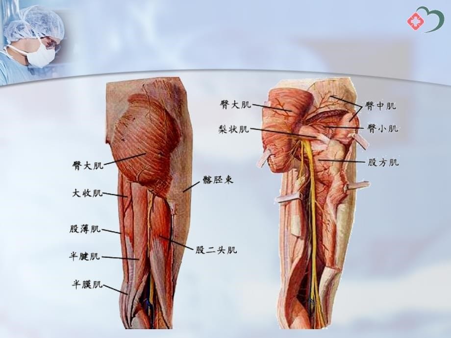 犁状肌综合征腰肌劳损_第5页