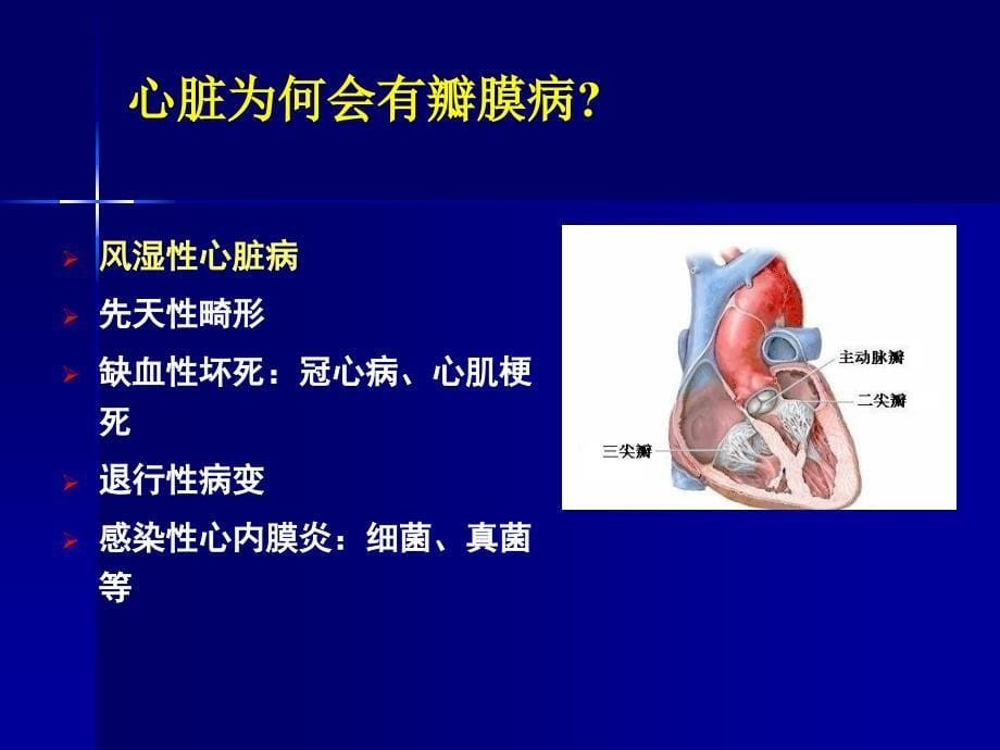 二尖瓣狭窄讲课课件_第5页