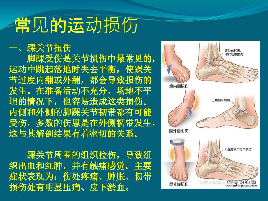 常见损伤的应急处理与急救.ppt_第2页